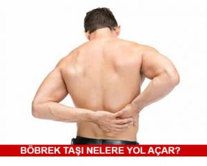 Böbrek Taşı Nelere Yol Açar?