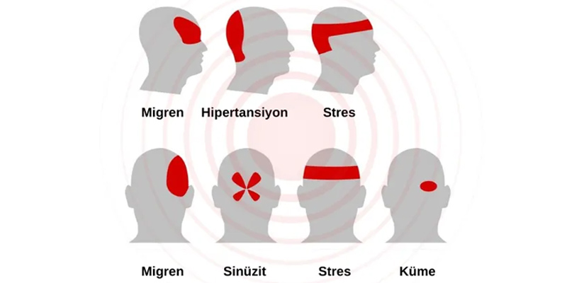 baş ağrısının nedenleri